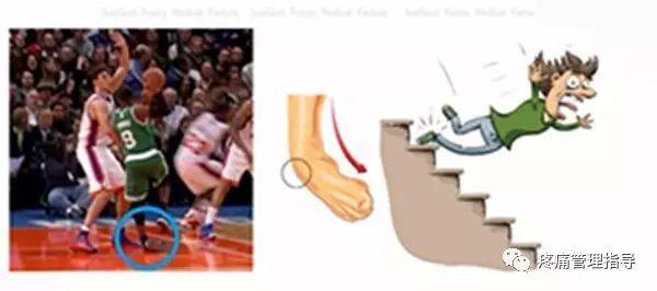 nba脚踝歪着肿了怎么办 NBA球星脚踝扭伤的处理方法(16)