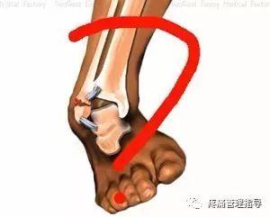 nba脚踝歪着肿了怎么办 NBA球星脚踝扭伤的处理方法(48)