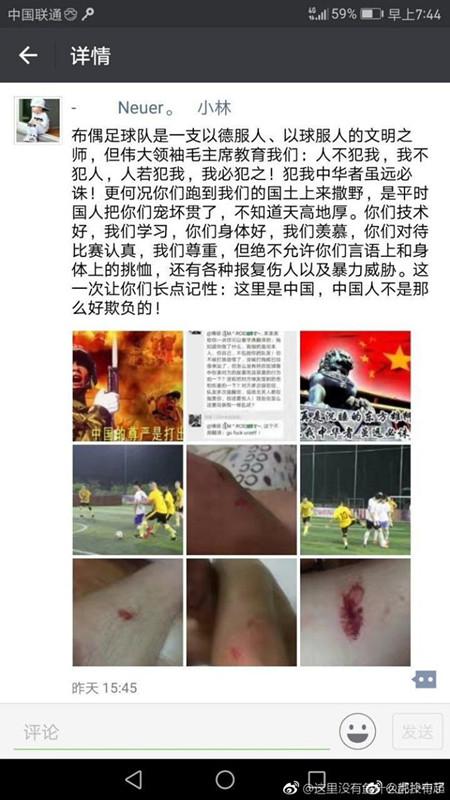 中超外籍黑人球员受伤 外籍球员在华踢球(2)
